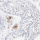 Immunohistochemical staining of human testis shows strong cytoplasmic positivity in Leydig cells and weaker nuclear positivity in cells in seminiferous ducts.