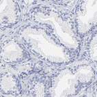 Immunohistochemical staining of human prostate shows no cytoplasmic positivity in glandular cells as expected.