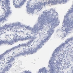 Immunohistochemical staining of human fallopian tube shows no cytoplasmic positivity in glandular cells as expected.