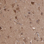 Anti-TANGO2 Antibody