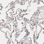 Immunohistochemical staining of human lung shows moderate granular cytoplasmic positivity in macrophages.