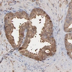 Immunohistochemical staining of human prostate shows moderate granular cytoplasmic positivity in glandular cells.