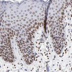 Immunohistochemical staining of human Skin shows strong nuclear membrane positivity in squamous epithelial cells.