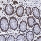 Immunohistochemical staining of human Rectum shows strong nuclear membrane positivity in glandular cells.