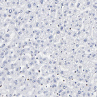Immunohistochemical staining of human Liver shows very weak nuclear membrane positivity in hepatocytes.