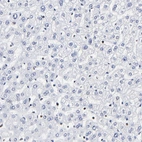 Immunohistochemical staining of human Liver shows very weak nuclear membrane positivity in hepatocytes.