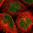 Immunofluorescent staining of human cell line A-431 shows localization to nuclear membrane & vesicles.