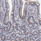 Anti-TMX1 Antibody