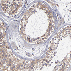 Immunohistochemical staining of human testis shows weak to moderate cytoplasmic positivity in cells in seminiferous ducts.