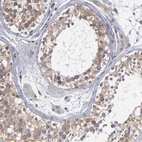 Immunohistochemical staining of human testis shows weak to moderate cytoplasmic positivity in cells in seminiferous ducts.