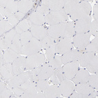 Immunohistochemical staining of human skeletal muscle shows no positivity in myocytes as expected.