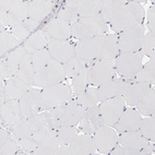 Immunohistochemical staining of human skeletal muscle shows no positivity in myocytes as expected.