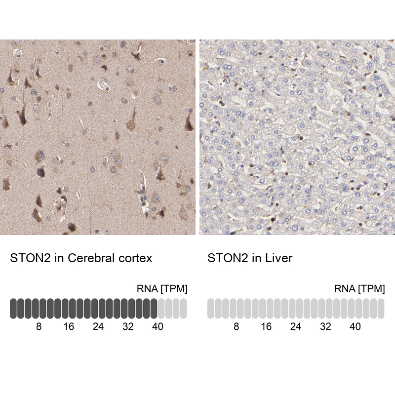 Anti-STON2 Antibody