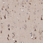 Immunohistochemical staining of human cerebral cortex shows moderate cytoplasmic positivity in neurons.