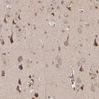Immunohistochemical staining of human cerebral cortex shows moderate cytoplasmic positivity in neurons.