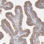 Immunohistochemical staining of human fallopian tube shows moderate cytoplasmic positivity in glandular cells.