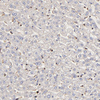 Immunohistochemical staining of human liver shows no positivity in hepatocytes as expected.