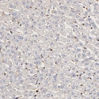 Immunohistochemical staining of human liver shows no positivity in hepatocytes as expected.