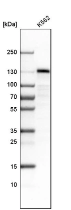 Western blot analysis in human cell line K562.