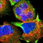 Immunofluorescent staining of human cell line A-431 shows positivity in nucleoli & cytoplasm.