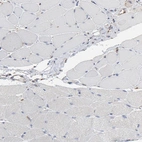 Immunohistochemical staining of human skeletal muscle shows low expression as expected.