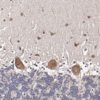 Anti-NF2 Antibody