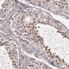 Immunohistochemical staining of human testis shows weak to moderate cytoplasmic positivity in cells in seminiferous ducts.