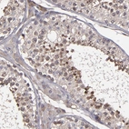 Immunohistochemical staining of human testis shows weak to moderate cytoplasmic positivity in cells in seminiferous ducts.