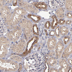 Anti-NF2 Antibody