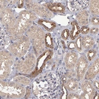 Immunohistochemical staining of human kidney shows moderate membranous positivity in cells in distal tubules.