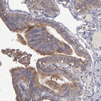 Immunohistochemical staining of human fallopian tube shows moderate apical membrane positivity in glandular cells.
