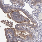 Immunohistochemical staining of human fallopian tube shows moderate apical membrane positivity in glandular cells.