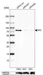 Western blot analysis in U2OS cells transfected with control siRNA, target specific siRNA probe #1 and #2, using Anti-NF2 antibody. Remaining relative intensity is presented. Loading control: Anti-GAPDH.