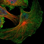 Immunofluorescent staining of human cell line U-251 MG shows localization to plasma membrane & cytosol.