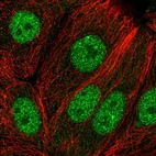 Immunofluorescent staining of human cell line MCF7 shows localization to nucleoplasm.
