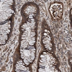 Immunohistochemical staining of human rectum shows strong cytoplasmic positivity in glandular cells.