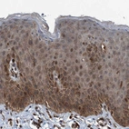 Immunohistochemical staining of human skin shows strong cytoplasmic positivity in squamous epithelial cells.