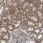 Immunohistochemical staining of human kidney shows strong cytoplasmic positivity in cells in tubules.