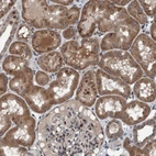 Immunohistochemical staining of human kidney shows strong cytoplasmic positivity in cells in tubules.