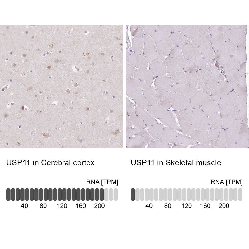 Anti-USP11 Antibody