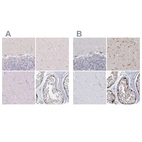 Immunohistochemical staining of human cerebellum, cerebral cortex, skeletal muscle and testis using Anti-USP11 antibody HPA003103 (A) shows similar protein distribution across tissues to independent antibody HPA037536 (B).
