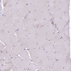 Anti-USP11 Antibody