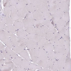 Immunohistochemical staining of human skeletal muscle shows no positivity in myocytes as expected.