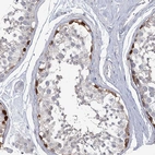 Immunohistochemical staining of human testis shows strong nuclear positivity in a subset of cells in seminiferous ducts.