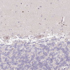 Immunohistochemical staining of human cerebellum shows weak nuclear positivity in Purkinje cells.