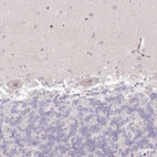 Immunohistochemical staining of human cerebellum shows weak nuclear positivity in Purkinje cells.