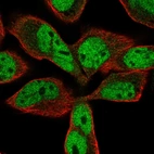 Immunofluorescent staining of human cell line RH-30 shows localization to nucleoplasm & cytosol.