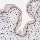 Anti-ELMSAN1 Antibody