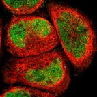 Immunofluorescent staining of human cell line A-431 shows localization to nucleoplasm.