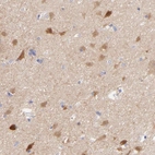 Anti-GPHN Antibody